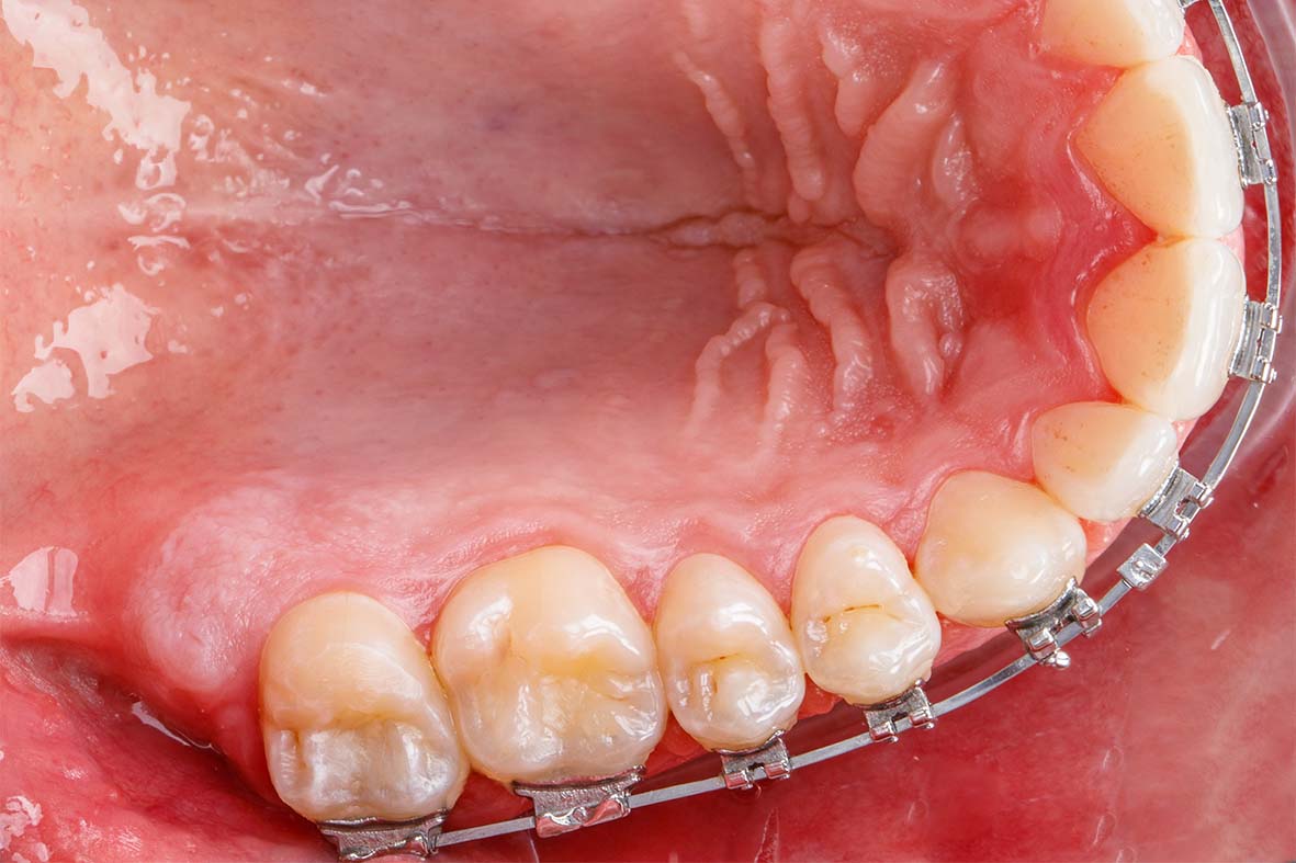 várias bocas em posições diferentes. com dentes, língua, sorriso