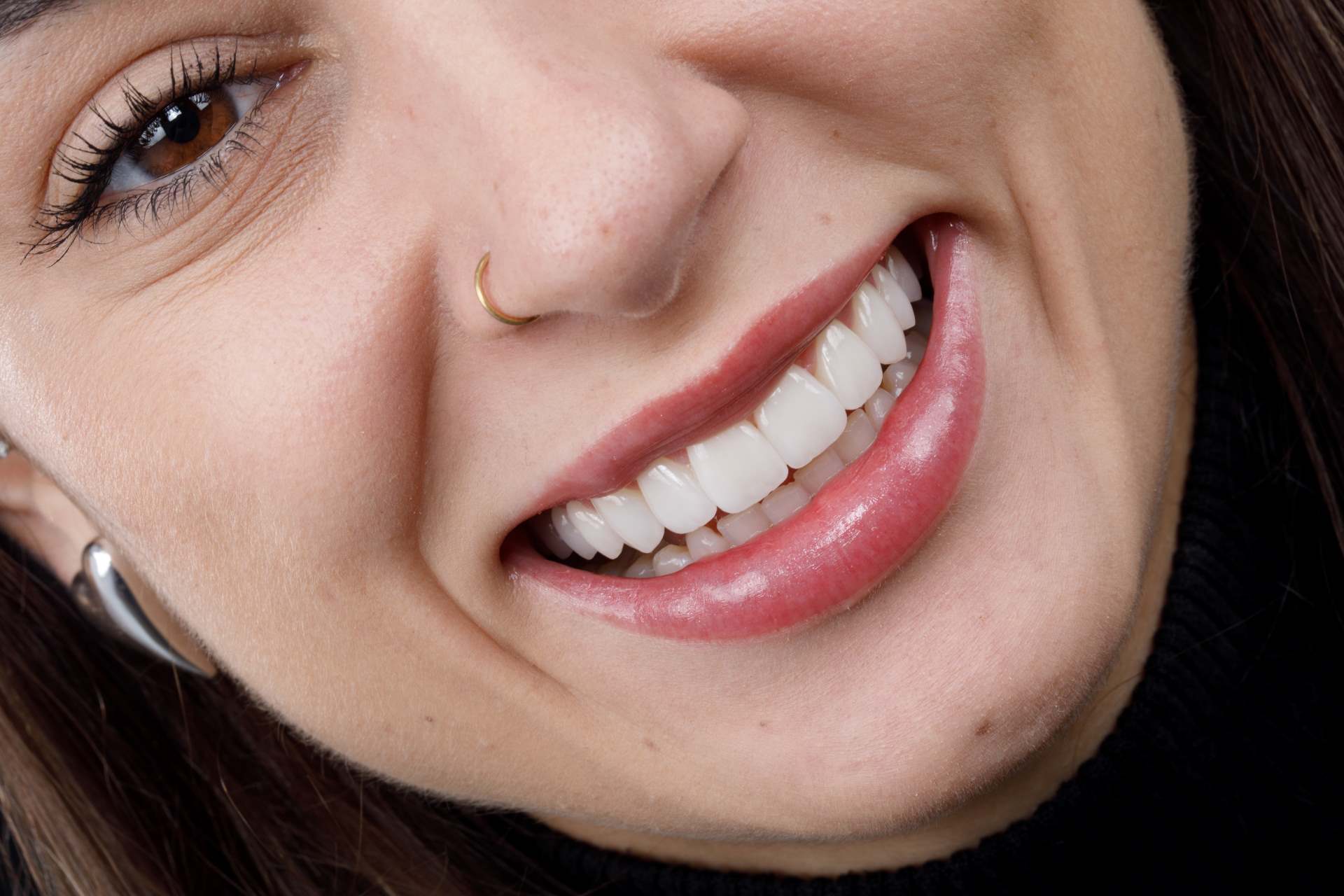 como tirar manchas dos dentes