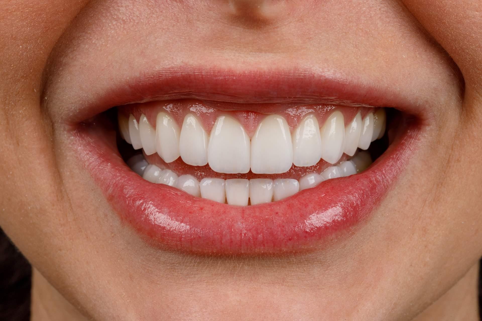 radiografia panoramica e tomografia computadorizada