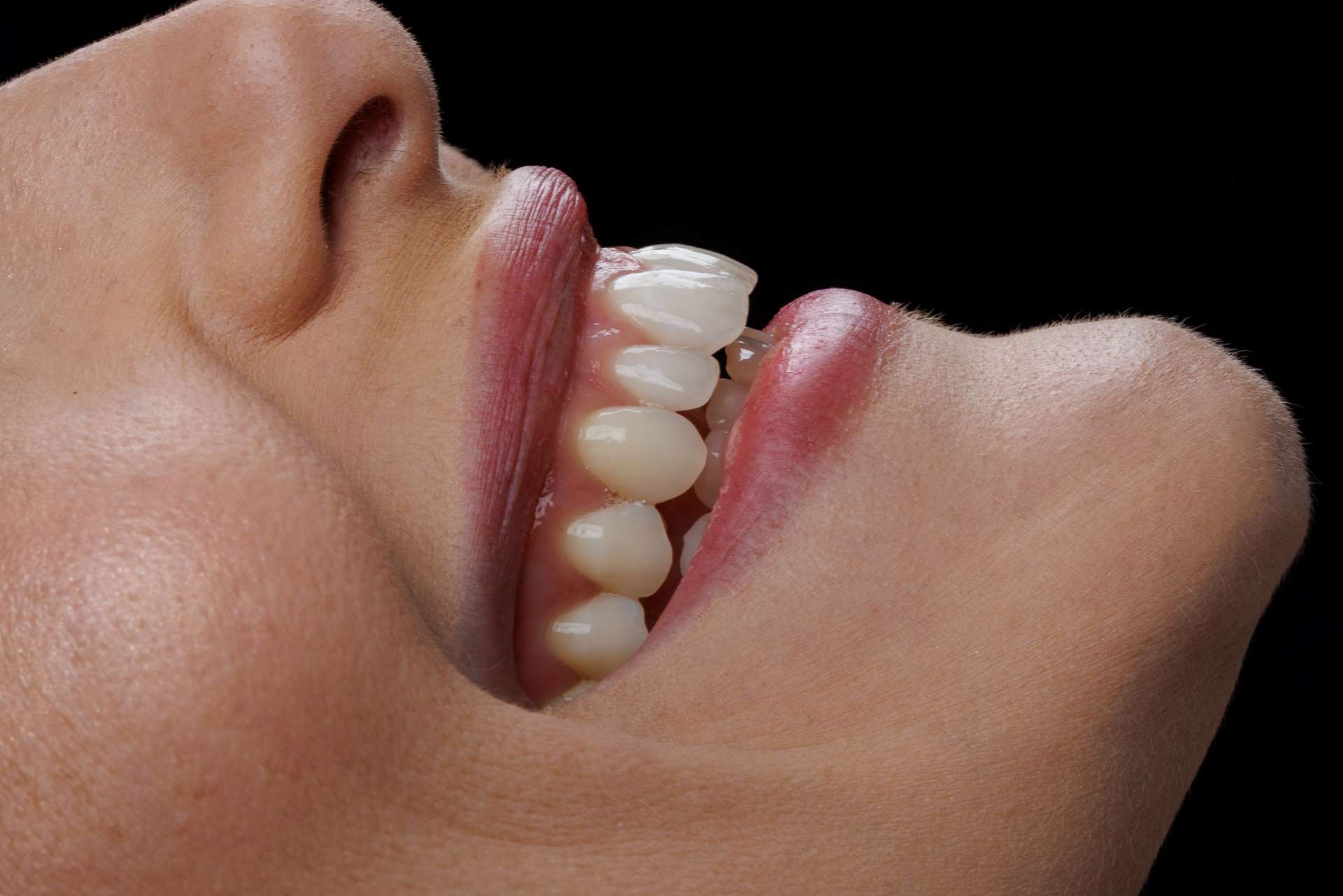 gengiva inflamada ou sangrando