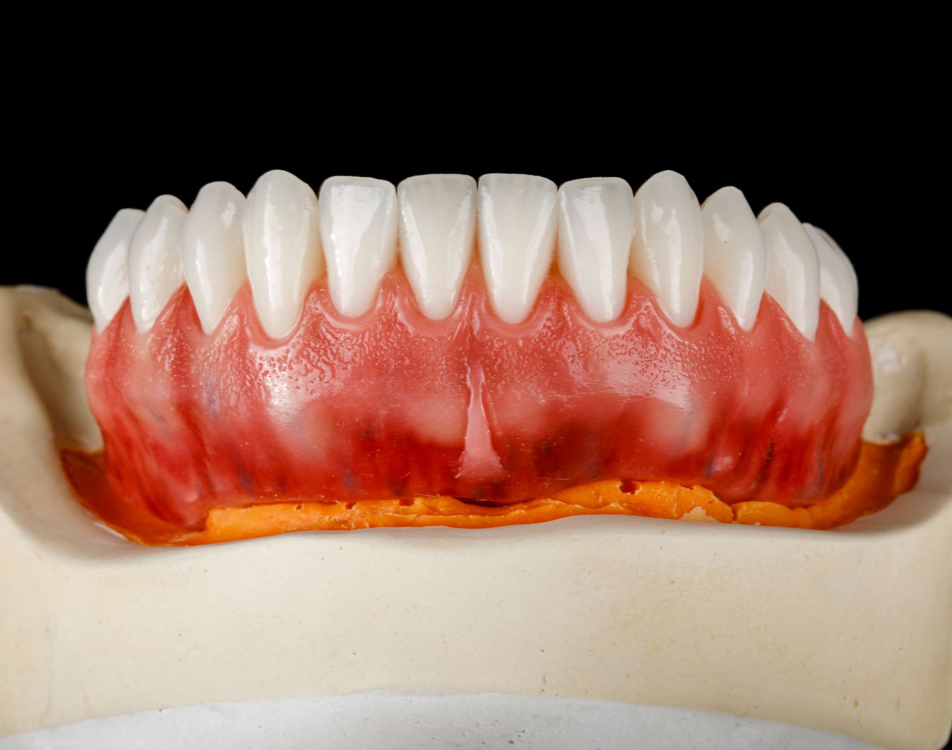 implantes dentarios dor custo tempo de recuperacao
