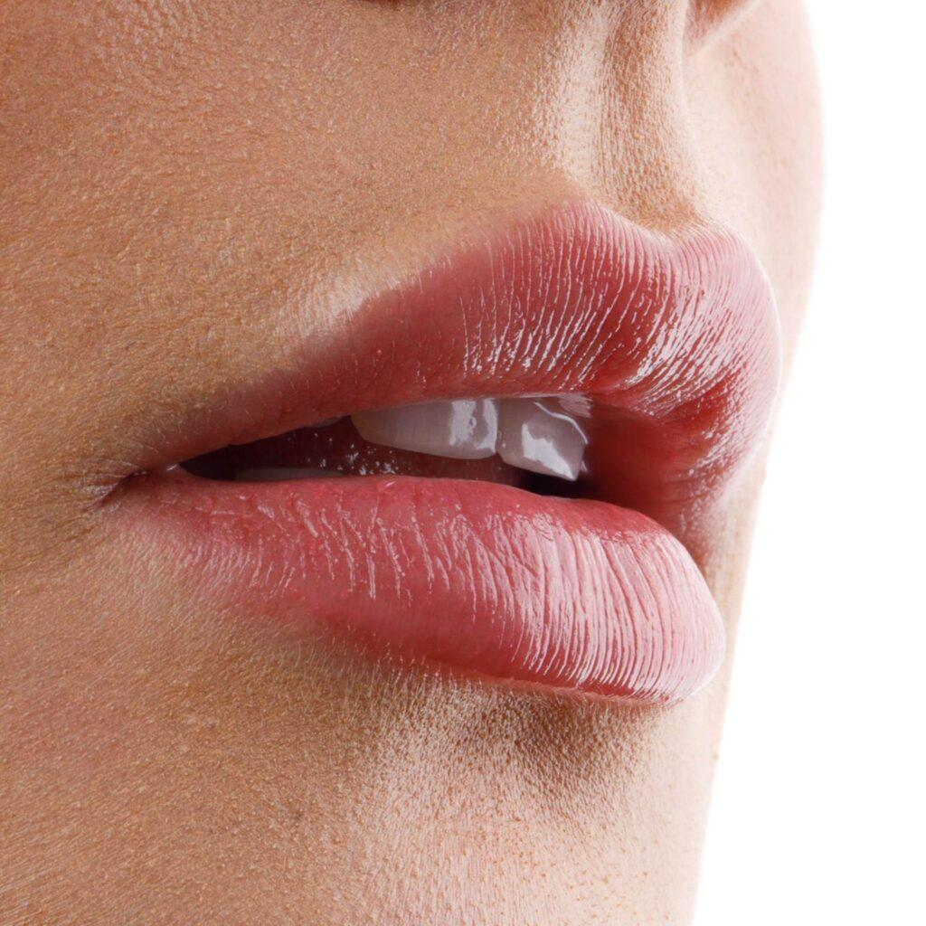 diastemas e espacos entre os dentes como resolver