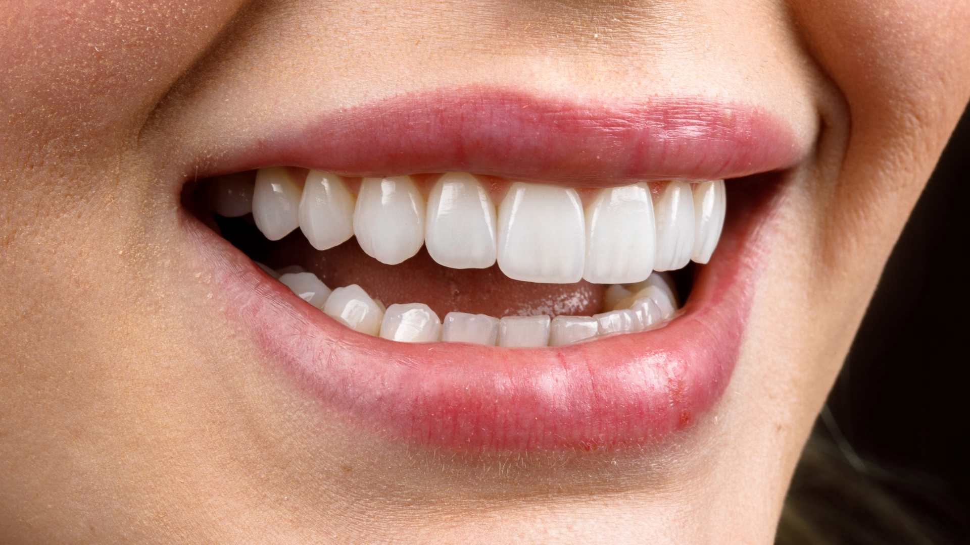 o que e pericoronarite