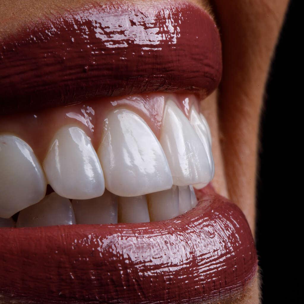 o que e odontologia estetica sorriso perfeito.jpg