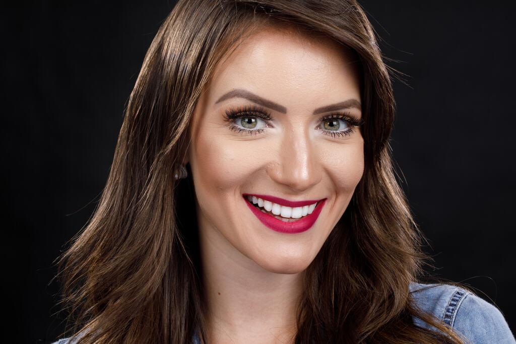 Resultado de clareamento dental profissional com dentes mais brancos e aparência natural do sorriso