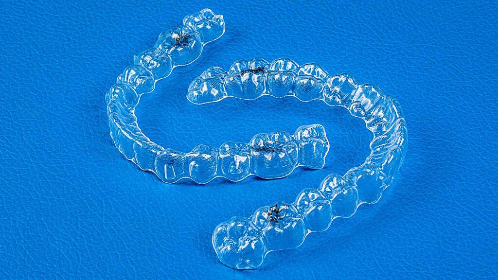 Alinhadores transparentes Invisalign posicionados sobre fundo azul, utilizados para alinhamento dental discreto.