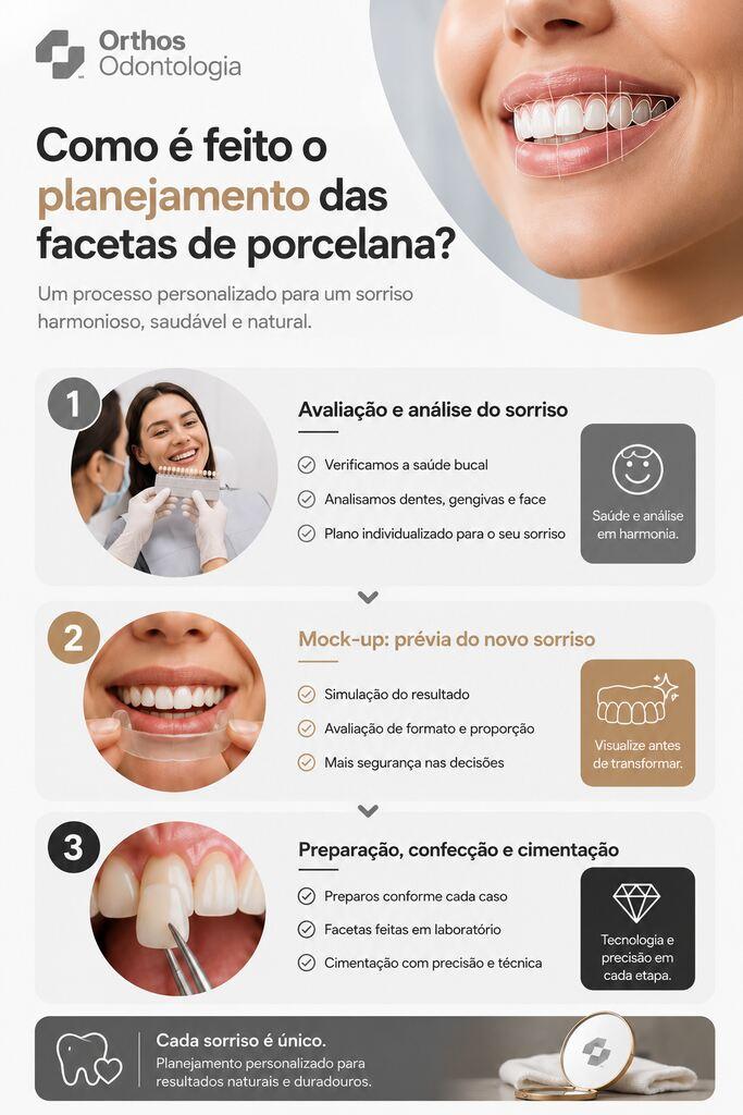 Infográfico mostra as etapas do planejamento, mock-up e aplicação de facetas para um sorriso personalizado.