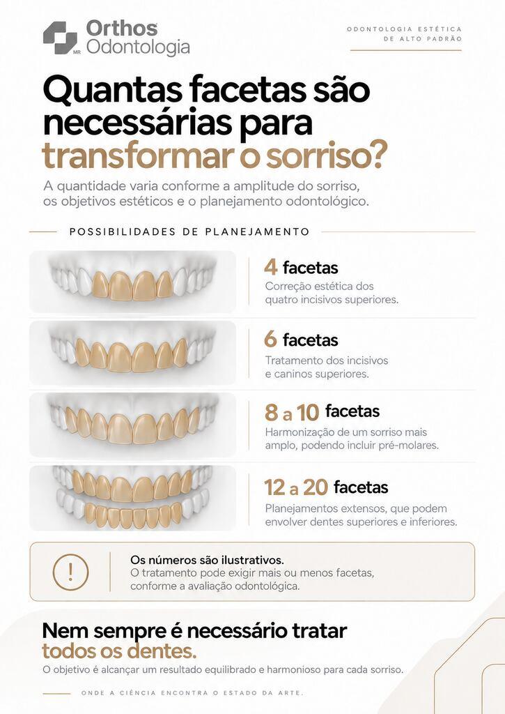 Infográfico da Orthos com arcadas dentárias e exemplos de tratamentos com 4, 6, 8 a 10 e 12 a 20 facetas.