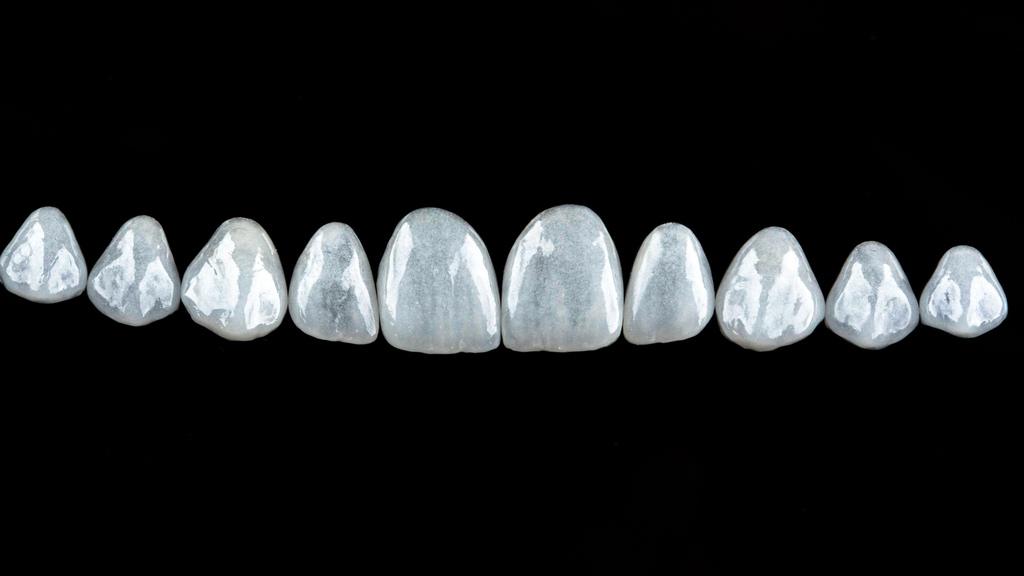 Facetas de porcelana alinhadas sobre fundo preto, ilustrando quem pode colocar facetas dentárias.