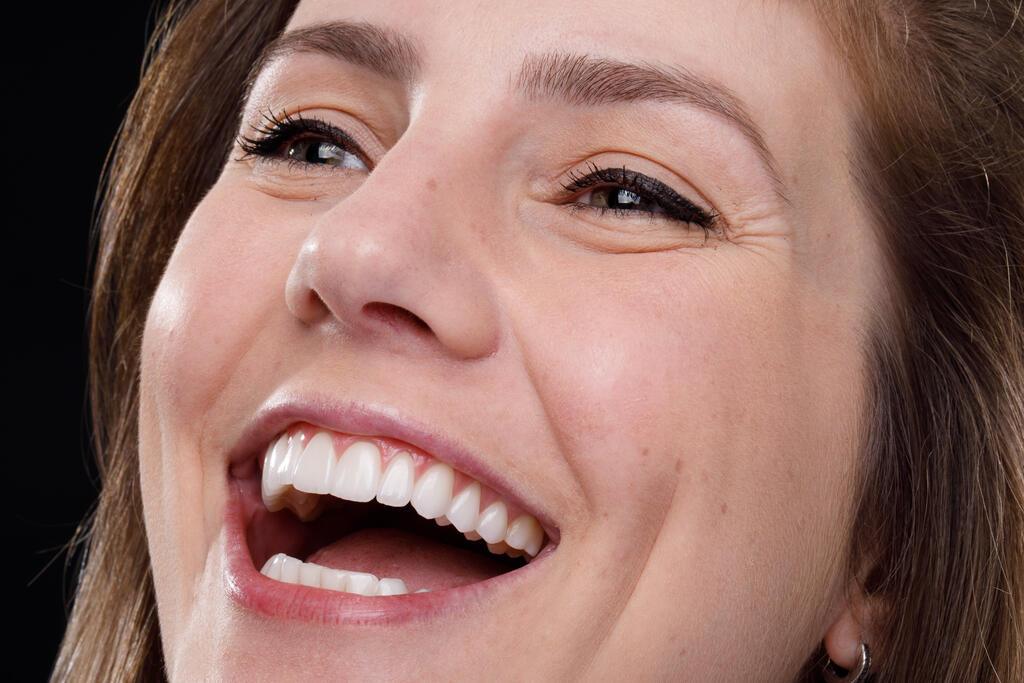 Mulher sorrindo com dentes claros e alinhados, mostrando resultado estético de tratamento odontológico.